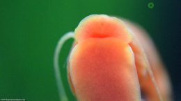 Green Spot Algae Near Red Ramshorn Snail